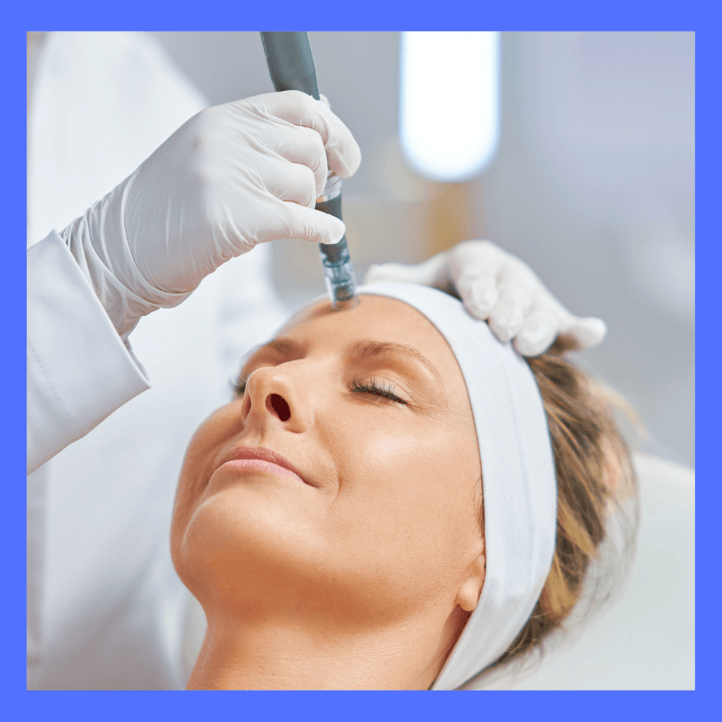 FACIAL SKIN NEEDLING ( with combination of PEELS )-1